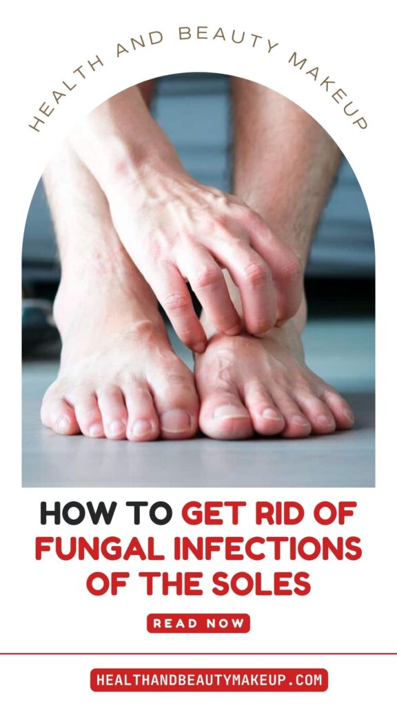 How To Get Rid Of Fungal Infections Of The Soles